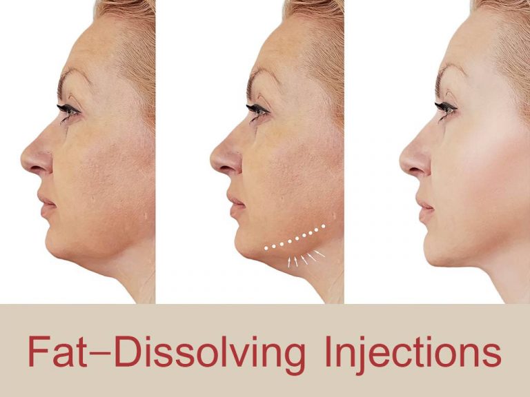 Fat dissolving injections - Dr Glancey Clinics